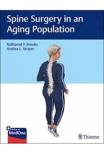 Spine Surgery In An Aging Population