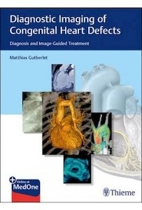 Diagnosis Imaging Of Congenital Heart Defects "Diagnosis And Image-Guided Treatment"
