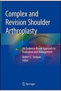 Complex And Revision Shoulder Arthroplasty "An Evidence-Based Approach To Evaluation And Management"
