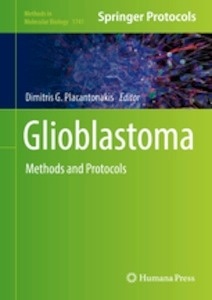 Glioblastoma "Methods and Protocols"