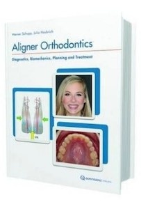 Aligner Orthodontics "Diagnostics, Biomechanics, Planning and Treatment"