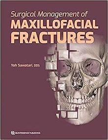 Surgical Management Of Maxillofacial Fractures