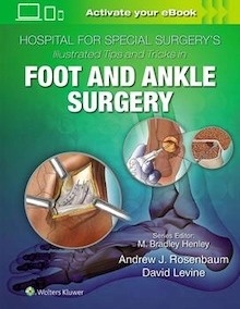 Illustrated Tips and Tricks in Foot and Ankle Surgery "Hospital for Special Surgery's"