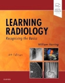 Learning Radiology "Recognizing the Basics"