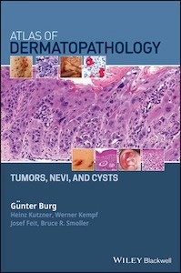 Atlas of Dermatopathology "Tumors, Nevi, and Cysts"