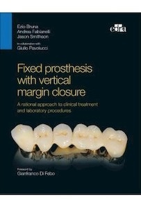 Fixed Prosthesis With Vertical Margin Closure "A Rational Approach To Clinical Treatment And Laboratory Procedures"
