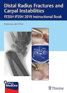 Distal Radius Fractures and Carpal Instabilities "FESSH IFSSH 2019 Instructional Book"
