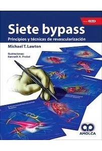 Siete Bypass "Principios y Técnicas de Revascularización"