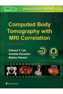 Computed Body Tomography With Mri Correlation