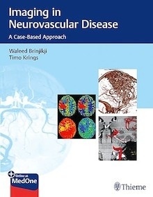 Imaging in Neurovascular Disease "A Case-Based Approach"