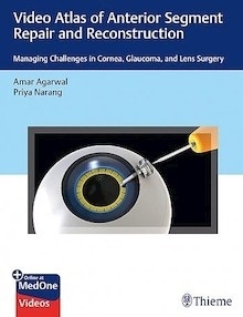 Video Atlas Of Anterior Segment Repair And Reconstruction "Managing Challenges In Cornea, Glaucoma, And Lens Surgery"