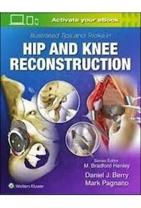 Illustrated Tips And Tricks In Hip And Knee Reconstruction