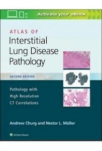 Atlas Of Interstitial Lung Disease Pathology