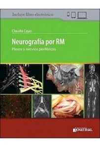 Neurografía por RM "Plexos y Nervios Periféricos"