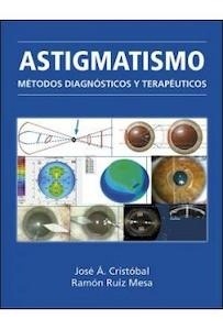 Astigmatismo "Métodos Diagnósticos y Terapéuticos"