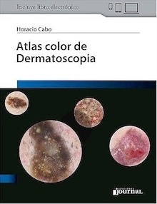 Atlas a Color de Dermatoscopia