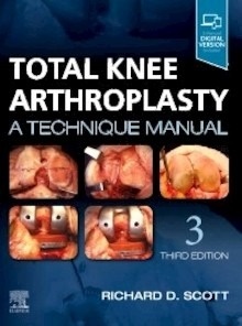Total Knee Arthroplasty "A Technique Manual"