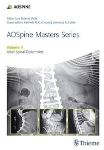 AO Spine Masters Series Vol. 4 Adult Spinal Deformities