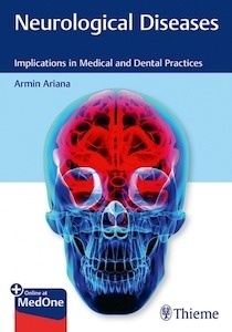 Neurological Diseases "Implications in Medical and Dental Practices"