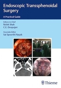 Endoscopic Transsphenoidal Surgery "A Practical Guide"