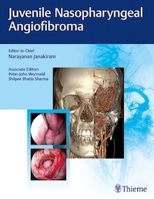 Juvenile Nasopharyngeal Angiofibroma