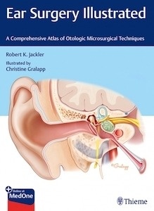 Ear Surgery Illustrated "A  Comprehensive Atlas of Otologic Microsurgical Techniques"