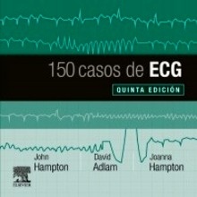 150 Casos de ECG