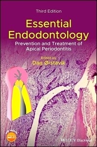 Essential Endodontology "Prevention and Treatment of Apical Periodontitis"