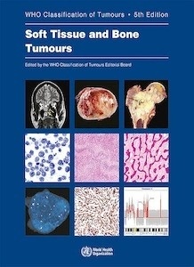Soft Tissue and Bone Tumours "WHO Classification of Tumours"
