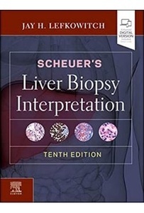 Scheuer"S Liver Biopsy Interpretation