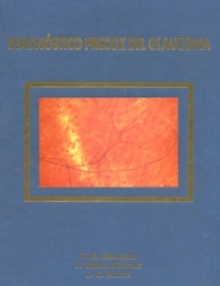 Diagnóstico precoz del glaucoma "LXXIII ponencia de la Sociedad Española de Oftalmología"