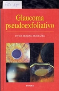 Glaucoma pseudoexfoliativo