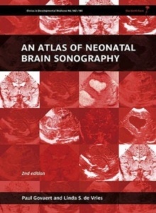 An Atlas Of Neonatal Brain Sonography (Clinics In Developmental Medicine Nº 182-183)