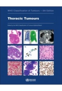 Who Classification Of Tumours. Thoracic Tumors