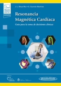 Resonancia Magnética Cardiáca "Guía para la Toma de Decisiones Clínicas"