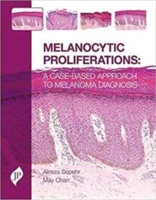 Melanocytic Proliferations "A Case-Based Approach to Melanoma Diagnosis"