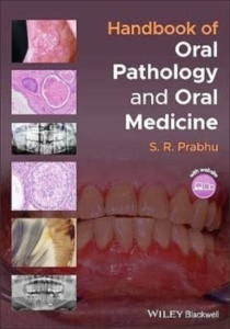 Handbook Of Oral Pathology And Oral Medicine