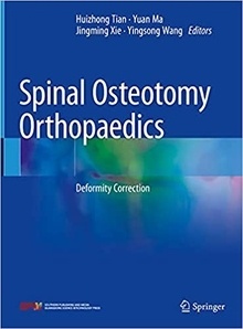 Spinal Osteotomy Orthopaedics "Deformity Correction"