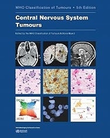 Who Classification Of Tumours Of The Central Nervous System