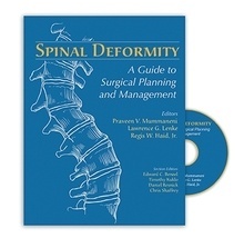 Spinal Deformity "A Guide to Surgical Planning and Management"