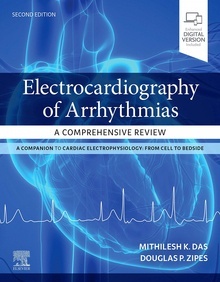 Electrocardiography Of Arrhythmias "A Comprehensive Review"