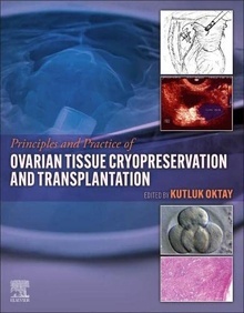 Principles And Practice Of Ovarian Tissue Cryopreservation And Transplantation