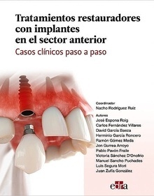 Tratamientos Restauradores con Implantes en el Sector Anterior "Casos Clínicos Paso a Paso"