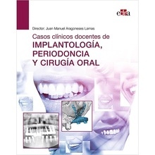 Casos Clínicos Docentes de Implantología, Periodoncia y Cirugía Oral