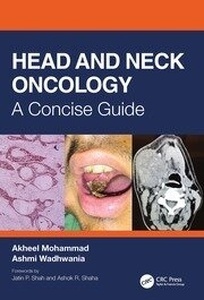 Head and Neck Oncology "A Concise Guide"