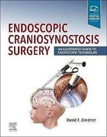 Endoscopic Craniosynostosis Surgery "An Illustrated Guide to Endoscopic Techniques"