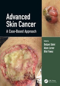 Advanced Skin Cancer "A Case-Based Approach"