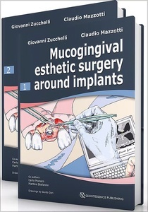 Mucogingival Esthetic Surgery Around Implants 2 Vols.