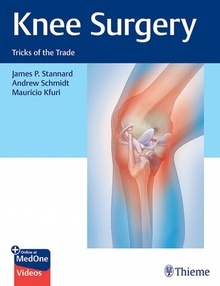 Knee Surgery "Tricks of the Trade"