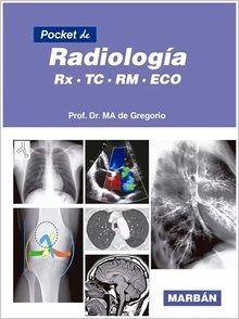 Pocket de Radiología. RX, TC, RM, ECO